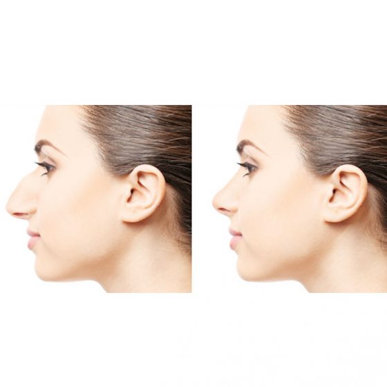 Clínica Levante Valencia